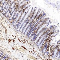 Immunohistochemistry analysis of paraffin-embedded Human colon using Vimentin Polyclonal Antibody at dilution of 1:300.