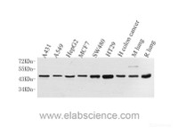 Western Blot analysis of various samples using CK-19 Polyclonal Antibody at dilution of 1:1000.