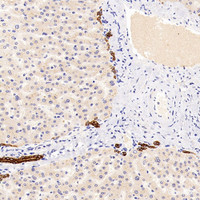 Immunohistochemistry analysis of paraffin-embedded human liver using CK-19 Polyclonal Antibody at dilution of 1:300.