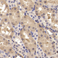 Immunohistochemistry analysis of paraffin-embedded mouse kidney using CK-19 Polyclonal Antibody at dilution of 1:300.