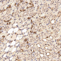 Immunohistochemistry analysis of paraffin-embedded rat kidney using CK-19 Polyclonal Antibody at dilution of 1:300.