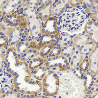 Immunohistochemistry analysis of paraffin-embedded rat kidney using HSP60 Polyclonal Antibody at dilution of 1:500.