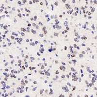 Immunohistochemistry analysis of paraffin-embedded fetal rat brain using SOX-2 Polyclonal Antibody at dilution of 1:300.