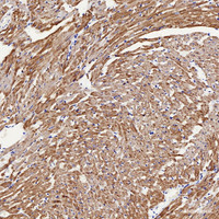 Immunohistochemistry analysis of paraffin-embedded rat heart using VDAC1 Polyclonal Antibody at dilution of 1:200.