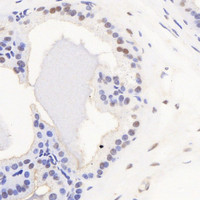 Immunohistochemistry analysis of paraffin-embedded mouse seminal vesicle using AR Polyclonal Antibody at dilution of 1:300.