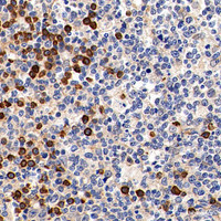 Immunohistochemistry analysis of paraffin-embedded Human tonsil using Cyclin B1 Polyclonal Antibody at dilution of 1:300.