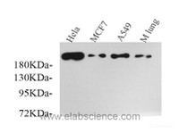 Western Blot analysis of various samples using SMARCA4 Polyclonal Antibody at dilution of 1:750.