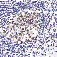 Immunohistochemistry analysis of paraffin-embedded Human tonsil using SMARCA4 Polyclonal Antibody at dilution of 1:300.