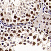 Immunohistochemistry analysis of paraffin-embedded mouse testis using SMARCA4 Polyclonal Antibody at dilution of 1:300.