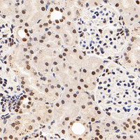 Immunohistochemistry analysis of paraffin-embedded rat kidney using SMARCA4 Polyclonal Antibody at dilution of 1:200.