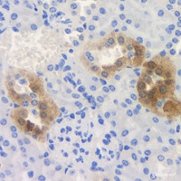 Immunohistochemistry analysis of paraffin-embedded mouse kidney using ROCK1 Polyclonal Antibody at dilution of 1:300.