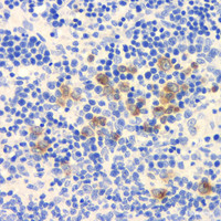 Immunohistochemistry analysis of paraffin-embedded rat spleen using ROCK1 Polyclonal Antibody at dilution of 1:300.