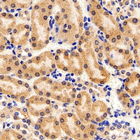 Immunohistochemistry analysis of paraffin-embedded Mouse kidney using FOXO1 Polyclonal Antibody at dilution of 1:300.