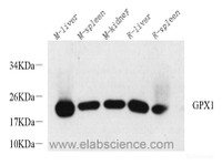 Western Blot analysis of various samples using GPX1 Polyclonal Antibody at dilution of 1:1000.