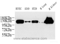Western Blot analysis of various samples using ITGAV Polyclonal Antibody at dilution of 1:600.