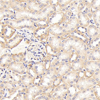 Immunohistochemistry analysis of paraffin-embedded mouse kidney using ITGAV Polyclonal Antibody at dilution of 1:400.