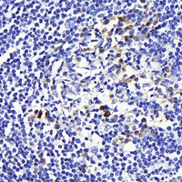 Immunohistochemistry analysis of paraffin-embedded human tonsil using CD169 Polyclonal Antibody at dilution of 1:300.
