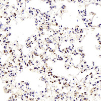 Immunohistochemistry analysis of paraffin-embedded Mouse lung using TEK Polyclonal Antibody at dilution of 1:300.