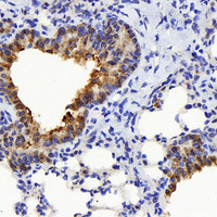 Immunohistochemistry analysis of paraffin-embedded mouse lung using TSC22D3 Polyclonal Antibody at dilution of 1:300.