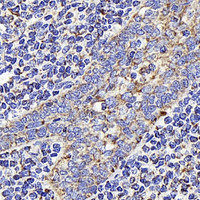 Immunohistochemistry analysis of paraffin-embedded human Tonsil using AIFM1 Polyclonal Antibody at dilution of 1:400.