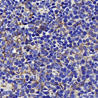 Immunohistochemistry analysis of paraffin-embedded mouse spleen using AIFM1 Polyclonal Antibody at dilution of 1:400.