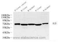 Western Blot analysis of various samples using ALB Polyclonal Antibody at dilution of 1:1000.