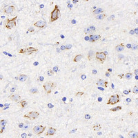 Immunohistochemistry analysis of paraffin-embedded mouse brain using DLL1 Polyclonal Antibody at dilution of 1:200.