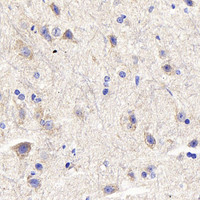 Immunohistochemistry analysis of paraffin-embedded mouse spinal marrow using DLL3 Polyclonal Antibody at dilution of 1:300.