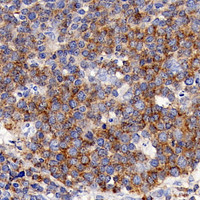 Immunohistochemistry analysis of paraffin-embedded human tonsil using CD192 Polyclonal Antibody at dilution of 1:300.