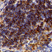 Immunohistochemistry analysis of paraffin-embedded Mouse spleen using CD192 Polyclonal Antibody at dilution of 1:300.