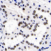 Immunohistochemistry analysis of paraffin-embedded human kidney using DNMT1 Polyclonal Antibody at dilution of 1:300.