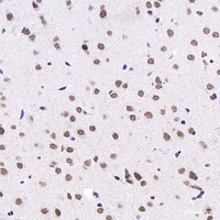 Immunohistochemistry analysis of paraffin-embedded mouse brain using c-Fos Monoclonal Antibody at dilution of 1:1000.