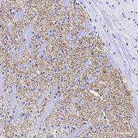 Immunohistochemistry analysis of paraffin-embedded mouse striatum using TH Monoclonal Antibody at dilution of 1:1000.