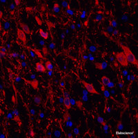 Immunofluorescence analysis of paraffin-embedded rat brain using TH Monoclonal Antibody at dilution of 1:400.