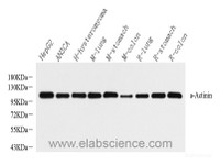 Western Blot analysis of various samples using ACTN1 Polyclonal Antibody at dilution of 1:2000.