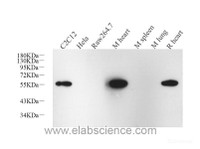 Western Blot analysis of various samples using Desmin Monoclonal Antibody at dilution of 1:1000.