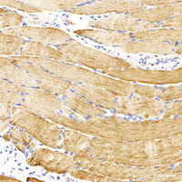 Immunohistochemistry analysis of parafffin-embedded rat skeletal muscle using Desmin Monoclonal Antibody at dilution of 1:300.