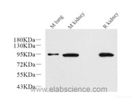 Western Blot analysis of various samples using Catenin beta Monoclonal Antibody at dilution of 1:1000.