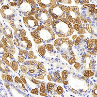 Immunohistochemistry analysis of paraffin-embedded mouse stomach using CK-19 Monoclonal Antibody at dilution of 1:1000.