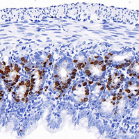 Immunohistochemistry analysis of paraffin-embedded mouse jejunum (intraperitoneal injection BrdU every 2 hours for 4 times) using Brdu Monoclonal Antibody at dilution of 1:300.