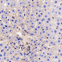 Immunohistochemistry analysis of paraffin-embedded mouse liver using E-Cadherin Monoclonal Antibody at dilution of 1:300.