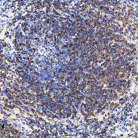 Immunohistochemistry analysis of paraffin-embedded mouse spleen using CD19 Polyclonal Antibody at dilution of 1:200.