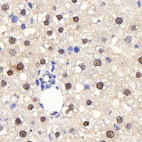 Immunohistochemistry analysis of paraffin-embedded rat liver using PPARA Polyclonal Antibody at dilution of 1:300.