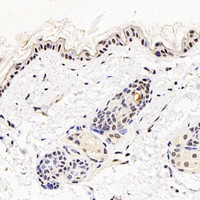 Immunohistochemistry analysis of paraffin-embedded mouse skin using MGMT Polyclonal Antibody at dilution of 1:300.