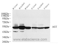 Western Blot analysis of various samples using AGT Polyclonal Antibody at dilution of 1:600.