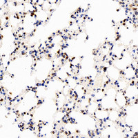 Immunohistochemistry analysis of paraffin-embedded Mouse lung using S100A4 Polyclonal Antibody at dilution of 1:400.