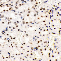 Immunohistochemistry analysis of paraffin-embedded Rat kidney using S100A4 Polyclonal Antibody at dilution of 1:400.