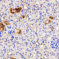 Immunohistochemistry analysis of paraffin-embedded mouse kidney using ATG7 Polyclonal Antibody at dilution of 1:300.