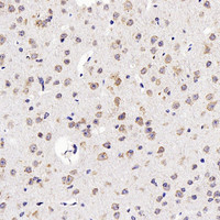 Immunohistochemistry analysis of paraffin-embedded mouse brain using GDNF Polyclonal Antibody at dilution of 1:300.