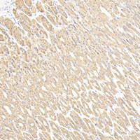 Immunohistochemistry analysis of paraffin-embedded mouse stomach cancer using CK-7 Monoclonal Antibody at dilution of 1:300.